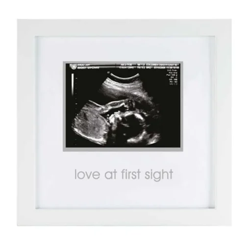Frames|Pearhead Sonogram Frame